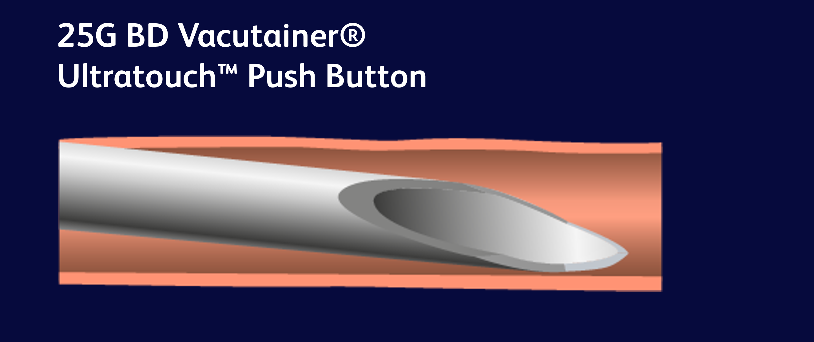 SSC_DVA1_IMG - AGULHA.png